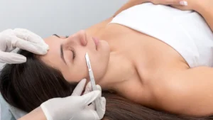 Dermaplaning