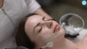 chemical peels